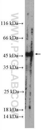 LMBRD1 Antibody in Western Blot (WB)