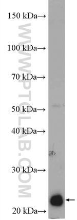 RAB5C Antibody in Western Blot (WB)