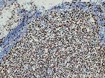 KI67 Antibody in Immunohistochemistry (Paraffin) (IHC (P))