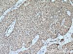 KI67 Antibody in Immunohistochemistry (Paraffin) (IHC (P))