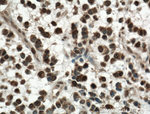 KI67 Antibody in Immunohistochemistry (Paraffin) (IHC (P))