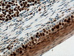 KI67 Antibody in Immunohistochemistry (Paraffin) (IHC (P))