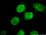 KI67 Antibody in Immunocytochemistry (ICC/IF)