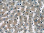 MRPL4 Antibody in Immunohistochemistry (Paraffin) (IHC (P))