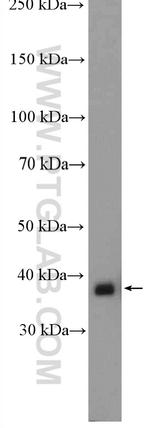 MRPL4 Antibody in Western Blot (WB)