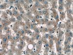 TAB1 Antibody in Immunohistochemistry (Paraffin) (IHC (P))