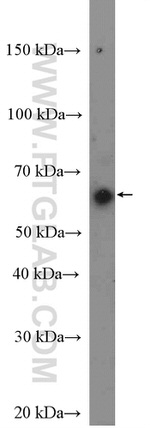 TAB1 Antibody in Western Blot (WB)