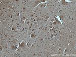 GABBR2 Antibody in Immunohistochemistry (Paraffin) (IHC (P))