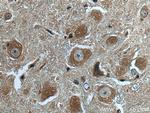 GABBR2 Antibody in Immunohistochemistry (Paraffin) (IHC (P))