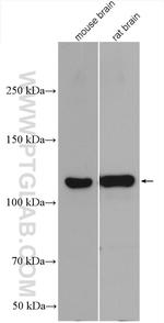 GABBR2 Antibody in Western Blot (WB)