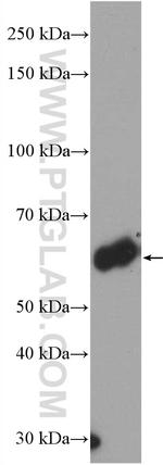 HAI-1 Antibody in Western Blot (WB)