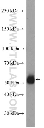 HAI-1 Antibody in Western Blot (WB)