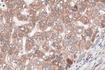 TNC/Tenascin-C Antibody in Immunohistochemistry (Paraffin) (IHC (P))