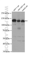 USP8 Antibody in Western Blot (WB)