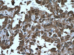 AKAP13 Antibody in Immunohistochemistry (Paraffin) (IHC (P))