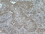 AKAP13 Antibody in Immunohistochemistry (Paraffin) (IHC (P))