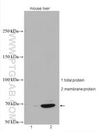 SLC22A9 Antibody in Western Blot (WB)