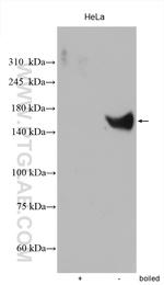 SLC12A2 Antibody in Western Blot (WB)