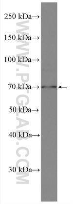 ZC3H14 Antibody in Western Blot (WB)