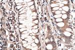 GLI3 Antibody in Immunohistochemistry (Paraffin) (IHC (P))