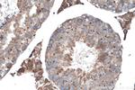 GLI3 Antibody in Immunohistochemistry (Paraffin) (IHC (P))