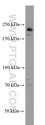 GLI3 Antibody in Western Blot (WB)