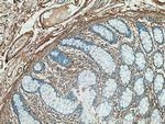 Collagen Type V Antibody in Immunohistochemistry (Paraffin) (IHC (P))