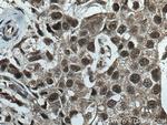 CUL1 Antibody in Immunohistochemistry (Paraffin) (IHC (P))