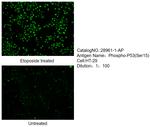 Phospho-P53 (Ser15) Antibody in Immunocytochemistry (ICC/IF)