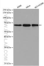 CBLL1 Antibody in Western Blot (WB)