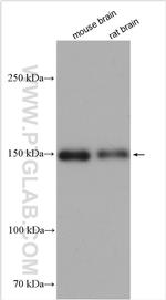 nNOS Antibody in Western Blot (WB)