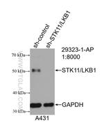 STK11/LKB1 Antibody in Western Blot (WB)