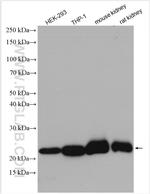 GPX1 Antibody in Western Blot (WB)