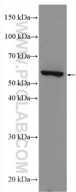 Cannabinoid receptor 2 Antibody in Western Blot (WB)