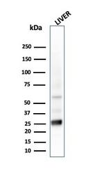 Glutathione S-Transferase Mu2 (GSTM2) Antibody in Western Blot (WB)