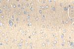 CRMP1 Antibody in Immunohistochemistry (Paraffin) (IHC (P))