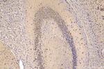 ERLEC1 Antibody in Immunohistochemistry (Paraffin) (IHC (P))