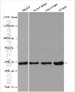 ERLEC1 Antibody in Western Blot (WB)