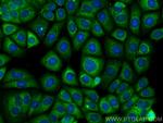 EIF2B5 Antibody in Immunocytochemistry (ICC/IF)