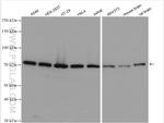 EIF2B5 Antibody in Western Blot (WB)