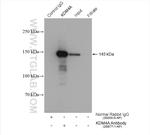 KDM4A Antibody in Immunoprecipitation (IP)