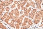 BCKDHA Antibody in Immunohistochemistry (Paraffin) (IHC (P))