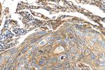 B7-H3 Antibody in Immunohistochemistry (Paraffin) (IHC (P))