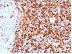 Annexin A1/ (Hairy Cell Leukemia Marker) Antibody in Immunohistochemistry (Paraffin) (IHC (P))