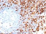 Annexin A1/ (Hairy Cell Leukemia Marker) Antibody in Immunohistochemistry (Paraffin) (IHC (P))