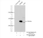 PACS2 Antibody in Immunoprecipitation (IP)