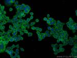 CD59 Antibody in Immunocytochemistry (ICC/IF)