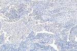 ARID1A Antibody in Immunohistochemistry (Paraffin) (IHC (P))