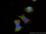 SYNJ2 Antibody in Immunocytochemistry (ICC/IF)