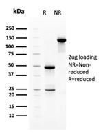 Heregulin-1/Neuregulin-1 (Breast and Urothelial Marker) Antibody in SDS-PAGE (SDS-PAGE)